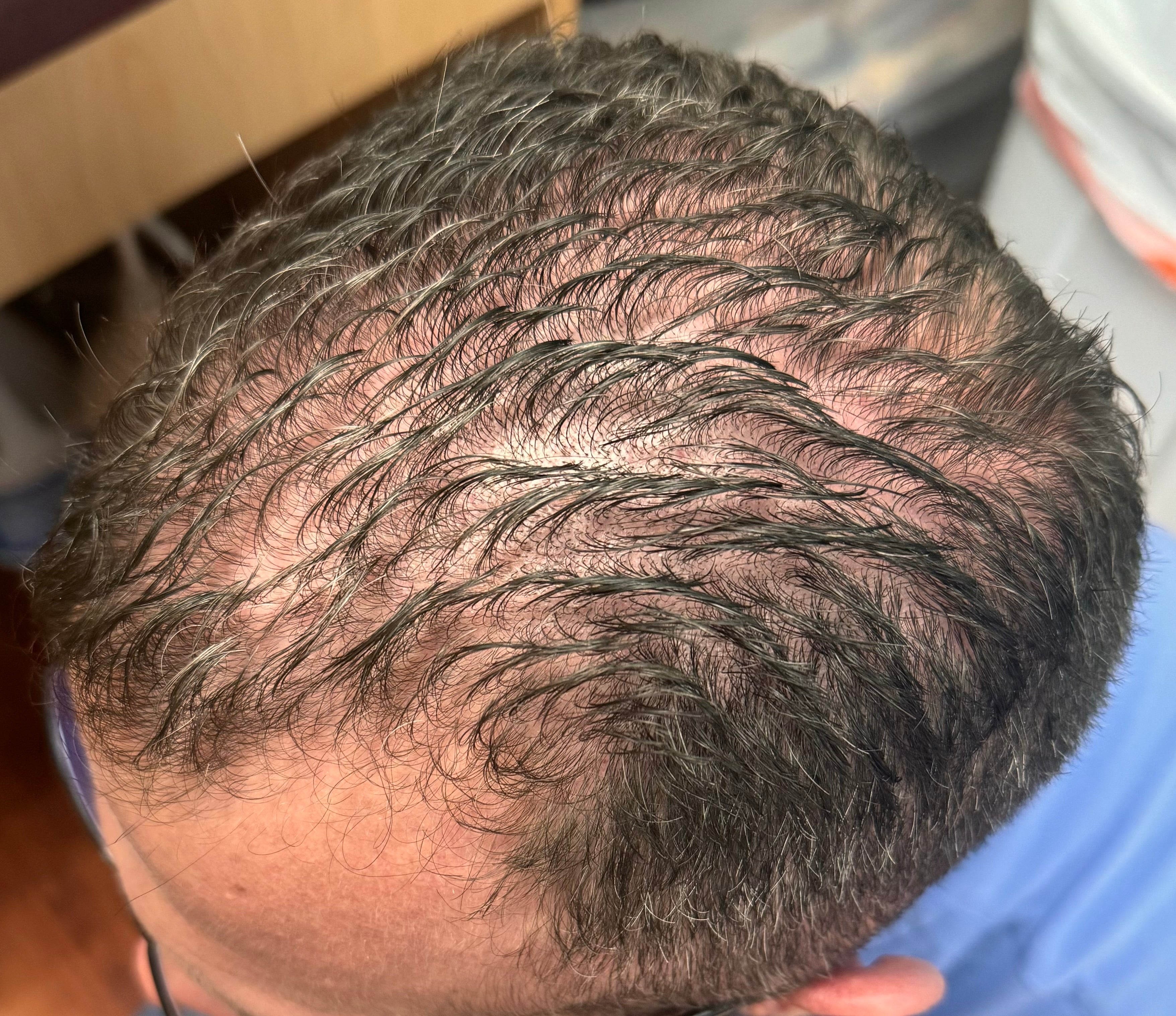 Ozone Hair Growth Oil