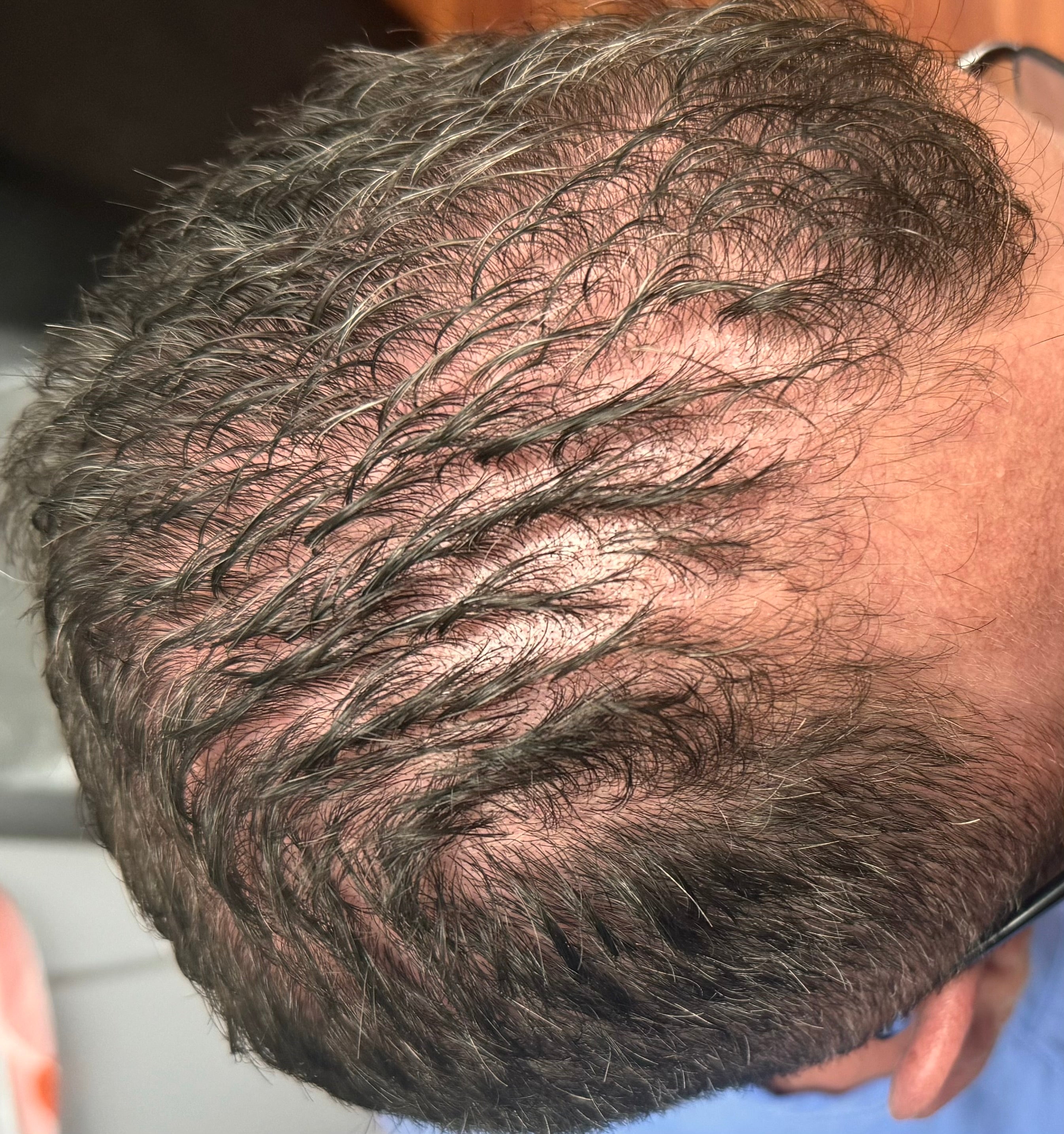 Ozone Hair Growth Oil