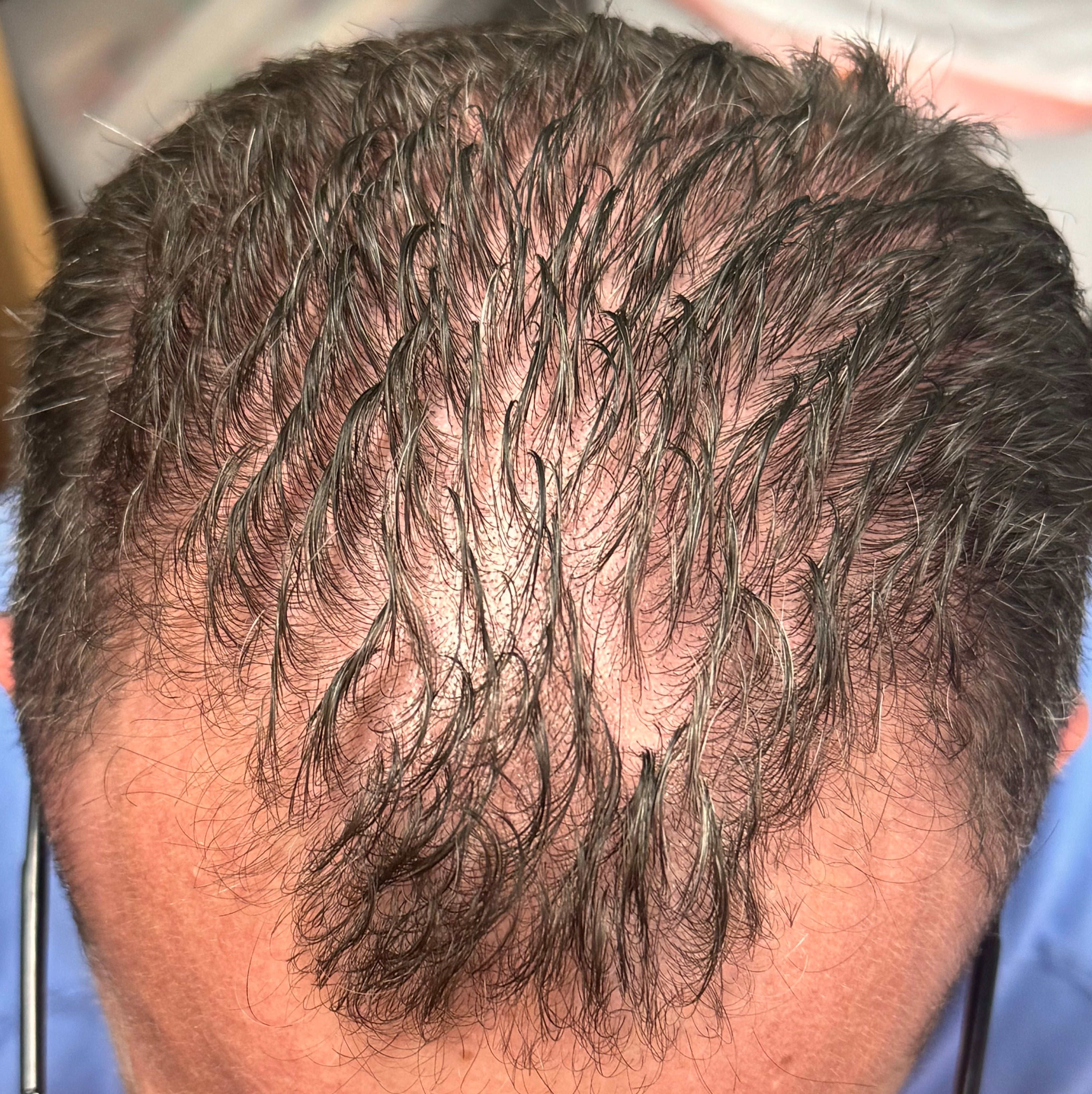 Ozone Hair Growth Oil