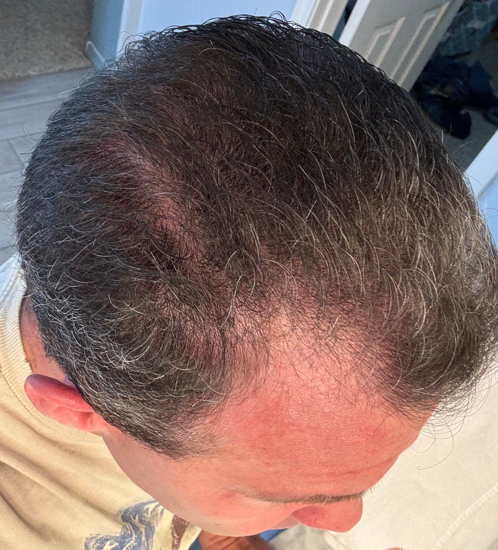 Ozone Hair Growth Oil