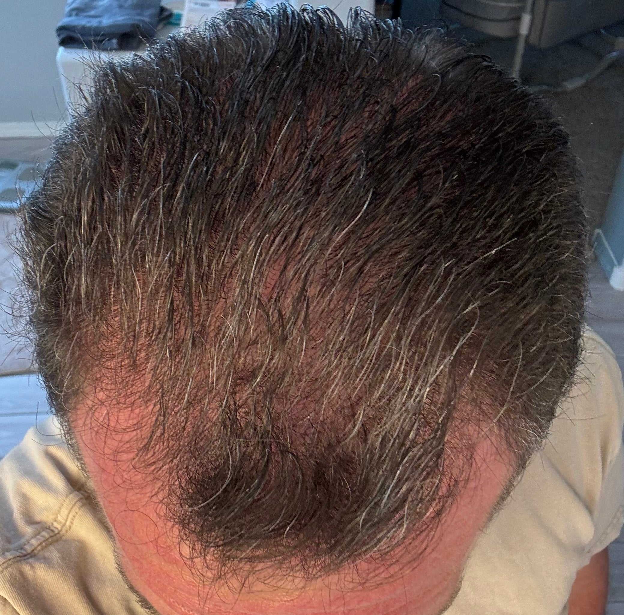 Ozone Hair Growth Oil