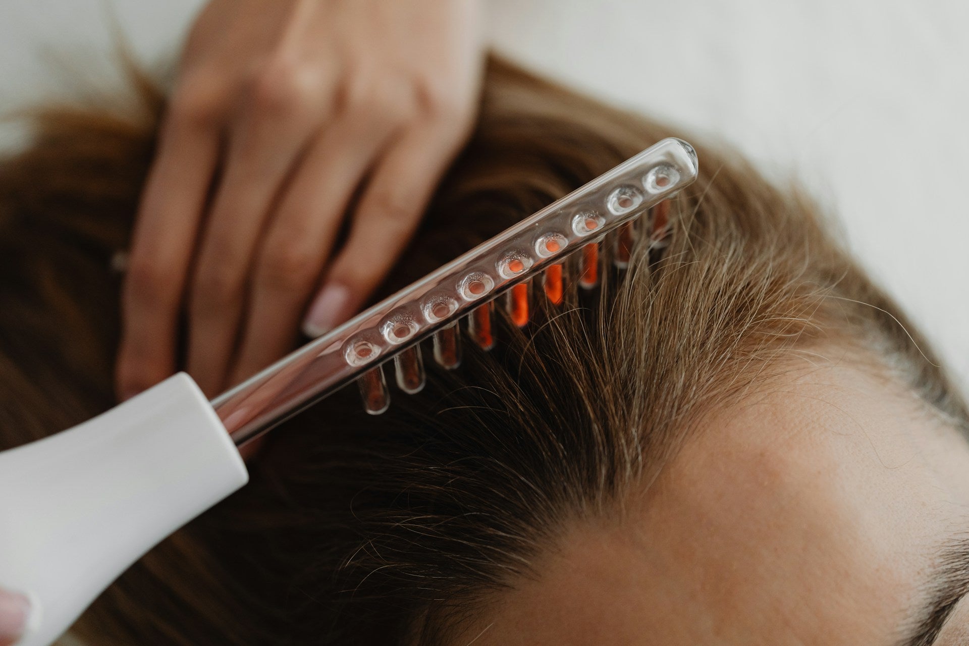scalp