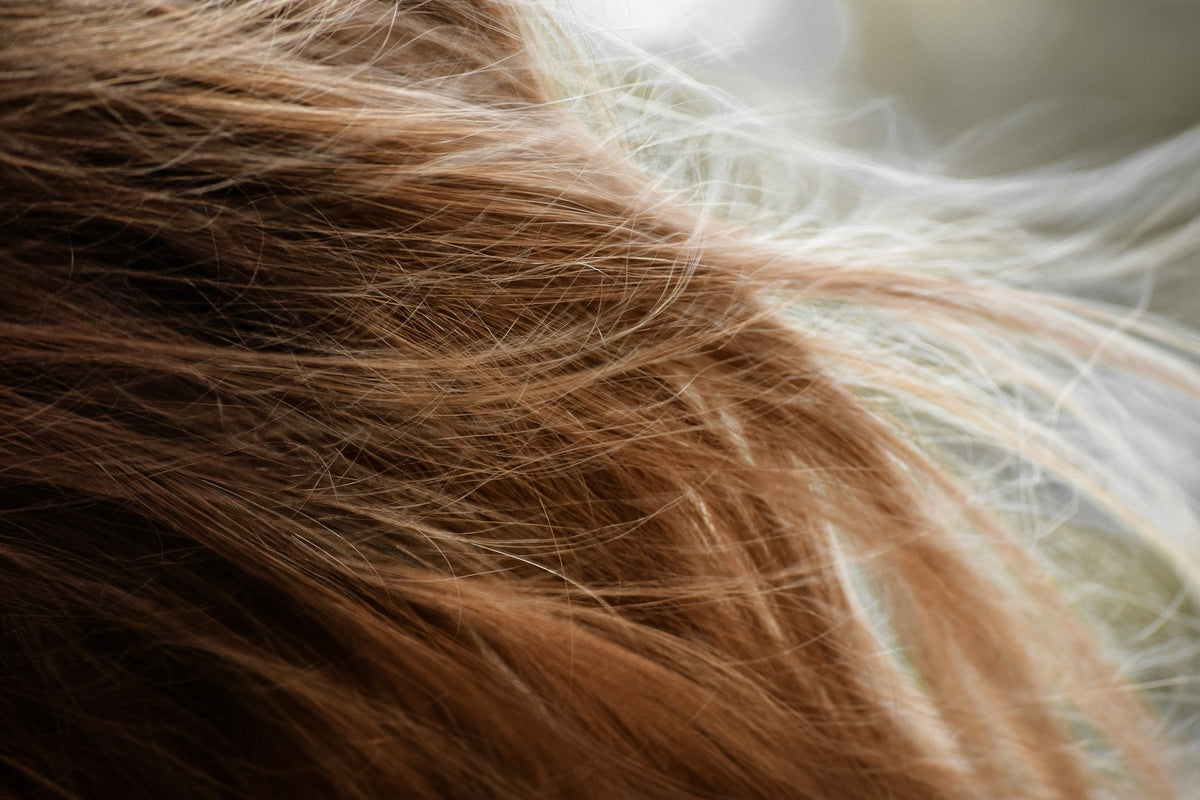 Hair Loss 