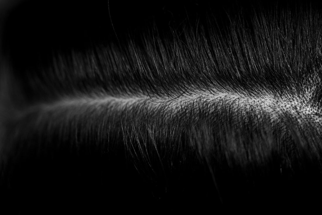 Scalp