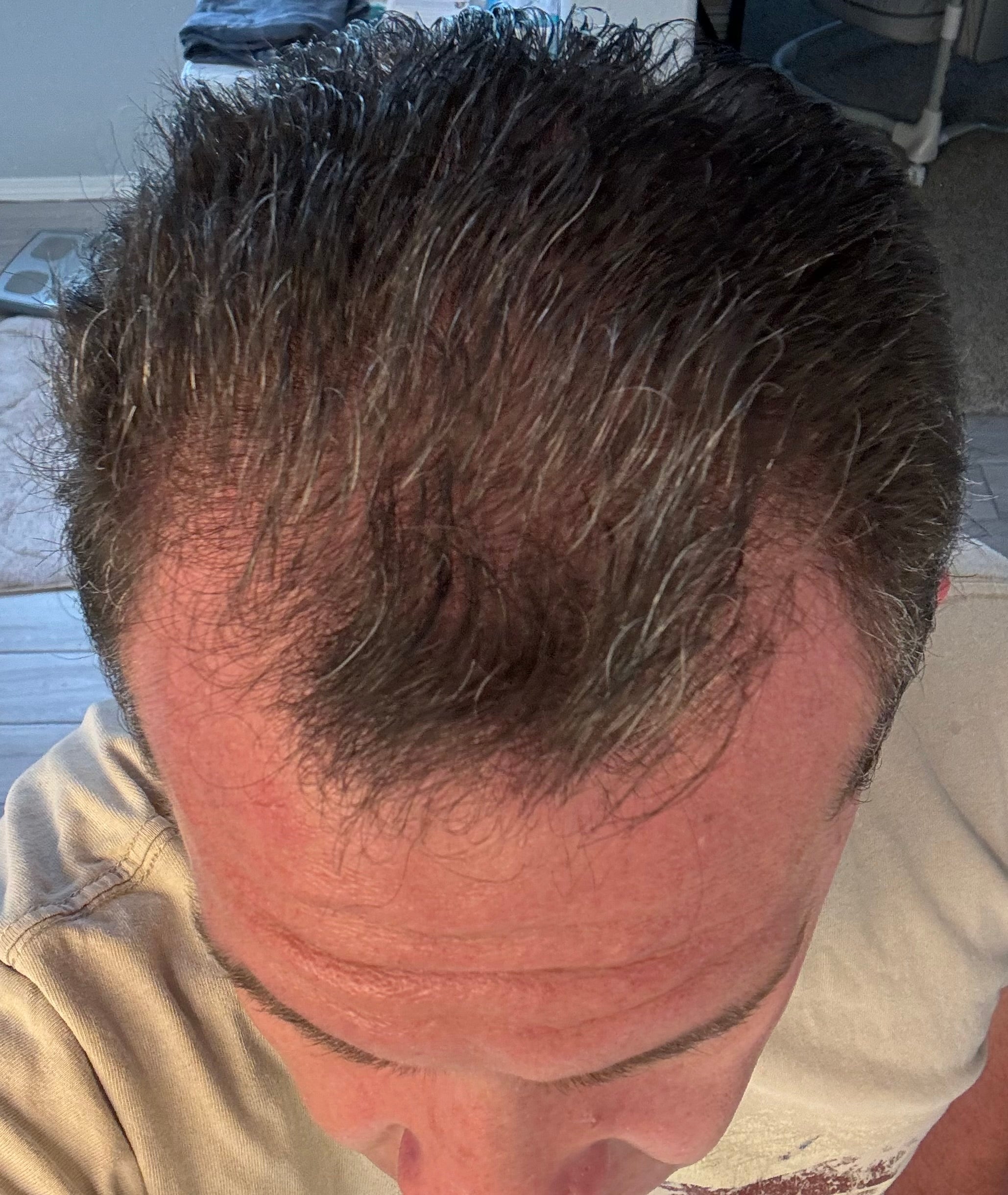 Ozone Hair Growth Oil