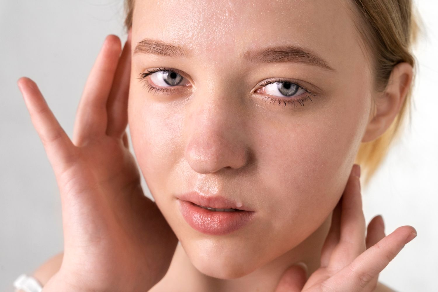 oily skin